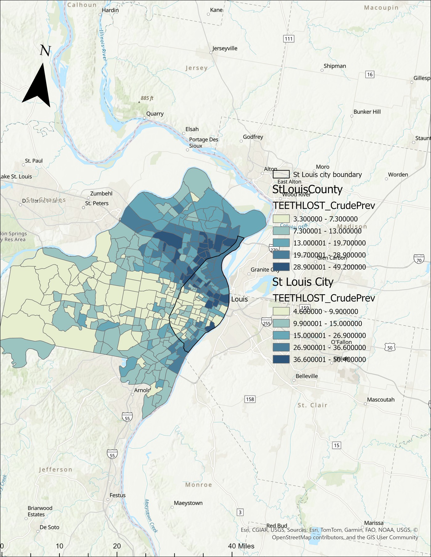 Tooth loss City vs County